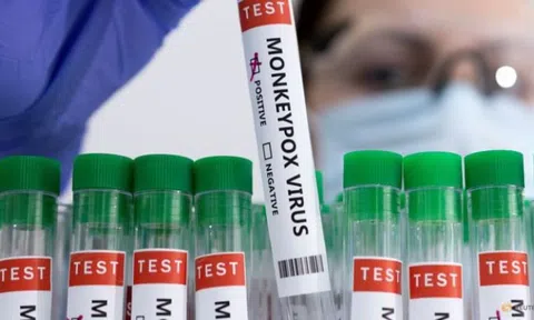 Số ca mắc đậu mùa khỉ tiếp tục tăng, WHO triệu tập cuộc họp thứ hai