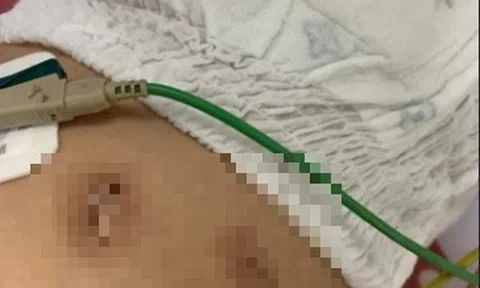 Sức khỏe bé gái 18 tháng tuổi bị đôi vợ chồng hành hạ ở Hà Nội hiện ra sao?