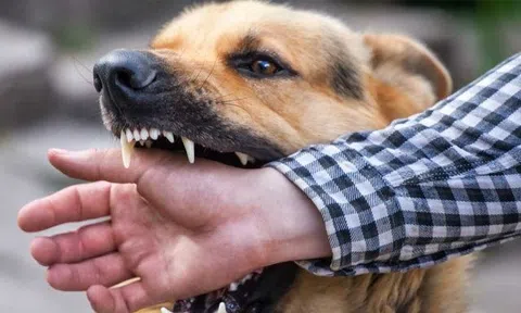 Người đàn ông 62 tuổi tử vong sau 3 tháng bị chó con cắn vào tay