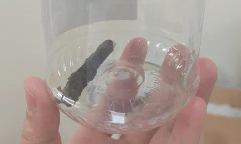 Chung sống với cành cây dài gần 7cm đâm xuyên phổi, nam thanh niên ho ra máu suốt 14 năm