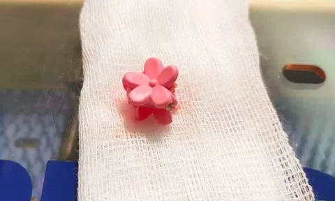 Dị vật bất ngờ khiến bé gái 5 tuổi ra dịch mủ âm đạo suốt 6 tháng trời