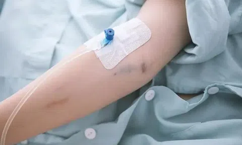Gọi y tá đến nhà truyền dịch, nam thanh niên sốc phản vệ nặng, tỷ lệ tử vong cao