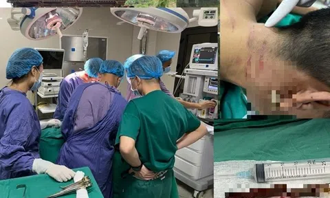 Cứu sống nam thanh niên bị thanh tre 15cm đâm xuyên cổ