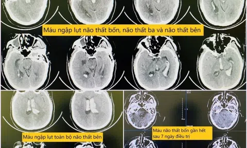 Người đàn ông bất ngờ đau đầu rồi gục xuống ghế khi đang làm việc tại cơ quan