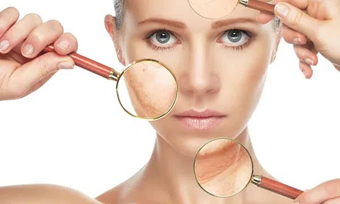 Thiếu ngủ ảnh hưởng thế nào đến làn da của bạn?