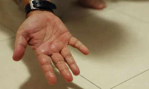 Khổ sở vì hàng xóm lắp tận 9 chiếc điều hòa trong căn hộ 4 phòng