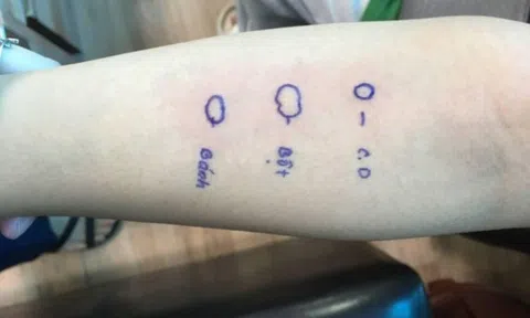 Cô gái trẻ ngất xỉu, nổi phát ban sau khi ăn bánh mì lót dạ