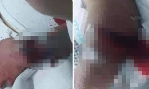 Diễn biến mới vụ thanh niên 19 tuổi chém bố và cậu ruột bạn gái trong ngày ra mắt