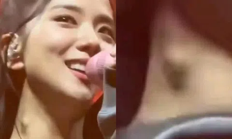 Người hâm mộ lo lắng cho tình trạng sức khỏe bất thường của Jisoo (Blackpink)