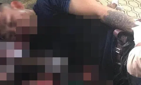 Nổ lớn ở quán cà phê, người đàn ông xăm trổ bị nát bàn tay