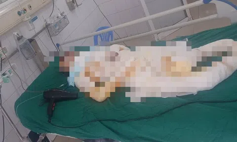 Vụ 3 con gái đổ xăng đốt nhà mẹ ruột ở Hưng Yên: Hé lộ tình trạng của người mẹ