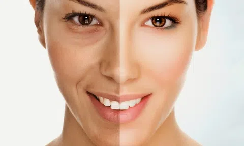 7 dấu hiệu cảnh báo cơ thể đang bị thiếu hụt collagen cần bổ sung gấp