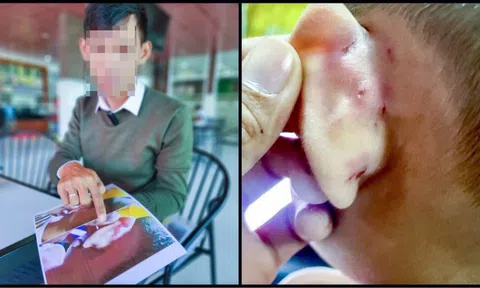 Tình tiết mới vụ cô giáo mầm non bạo hành bé trai 4 tuổi ở Kiên Giang