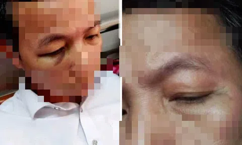 Quảng Bình: Xác minh thông tin hiệu trưởng đánh hiệu phó trong sân trường