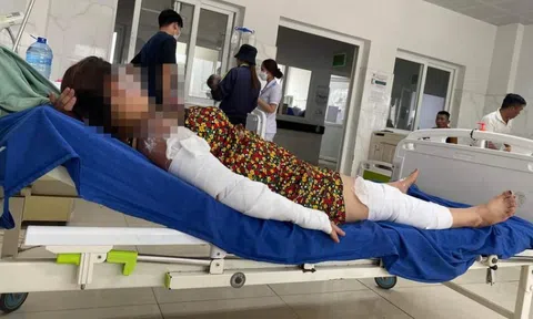 Nổ bình gas mini khi đang ăn lẩu, 7 người bị bỏng nhập viện