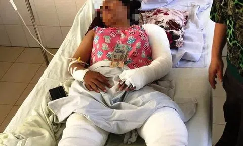 Mẹ kế tẩm xăng đốt sách vở của con chồng, khiến cả nhà bị bỏng nặng