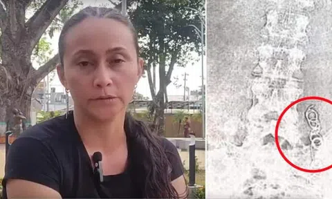 Tin tức đời sống ngày 30/4: Kim phẫu thuật bị bỏ quên trong bụng người phụ nữ 11 năm