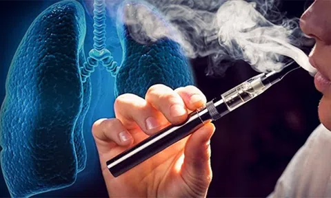 Bộ Y tế đề nghị xử lý nghiêm việc mua, bán, kinh doanh thuốc lá điện tử
