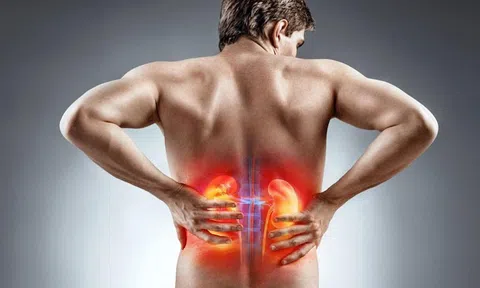 Bác sĩ cảnh báo: Làm 2 việc này thường xuyên, chắc chắn thận sẽ chịu không nổi