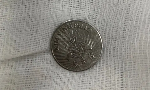 Bé gái 10 tuổi ngậm đồng xu chơi rồi vô tình nuốt phải