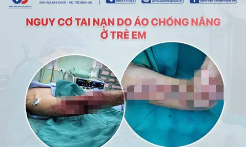 Nhập viện cấp cứu vì áo chống nắng cuốn vào xích xe máy