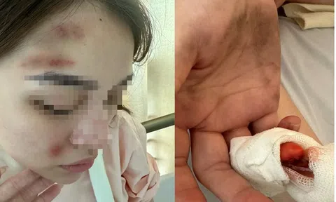 Xác minh thông tin cảnh sát hình sự ở Hải Phòng bị tố hành hung bạn gái