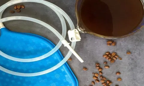Tin tức đời sống ngày 5/7: Người phụ nữ vỡ trực tràng do thải độc bằng cách thụt tháo cà phê
