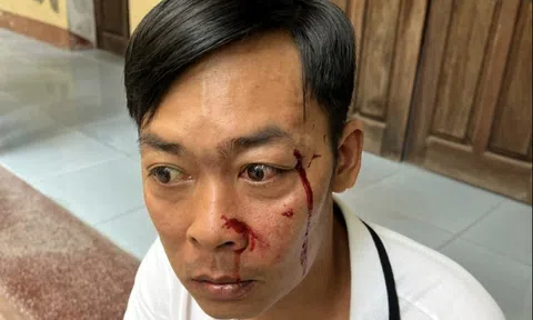 Huế: Xác minh vụ người đàn ông bị hành hung khi vừa rời trụ sở tòa án