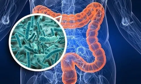 Những món ăn thường ngày đang gây hại đến đường ruột của bạn