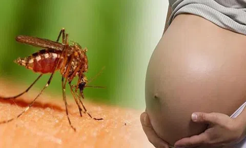 Những biến chứng cực nguy hiểm nếu phụ nữ đang mang thai mắc sốt xuất huyết