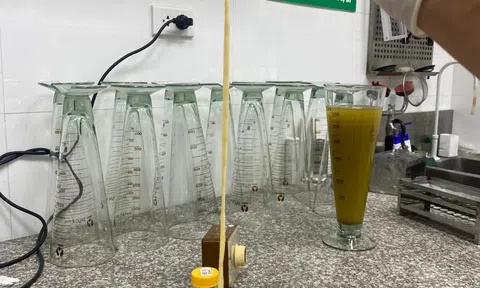 Ăn thịt bò tái, cô gái phát hiện “vật thể lạ” dài 6 mét trong cơ thể