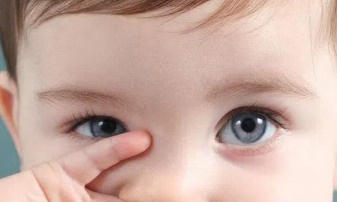 Dịch đau mắt đỏ có chiều hướng gia tăng, cha mẹ cần lưu ý những gì?