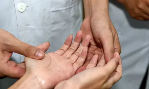 Nguyên nhân và cách khắc phục mồ hôi tay, mồ hôi chân hiệu quả