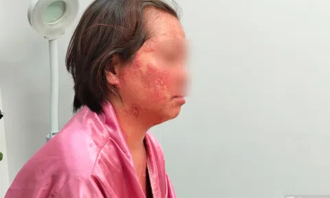 Nỗi đau của người phụ nữ mắc căn bệnh nhiều người không dám đến gần