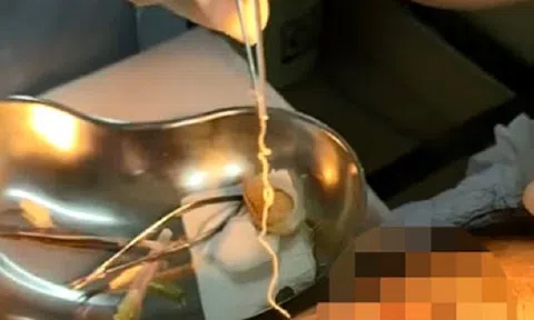 Thấy cộm mắt, người phụ nữ đi khám bất ngờ phát hiện "sinh vật lạ"