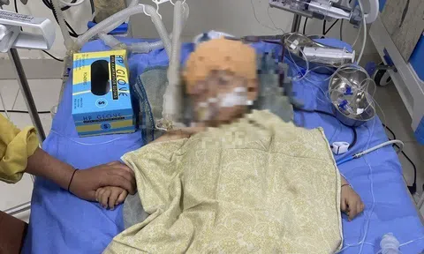 Vụ bé trai 1 tuổi chấn thương não ở trường mầm non: Tiết lộ bất ngờ