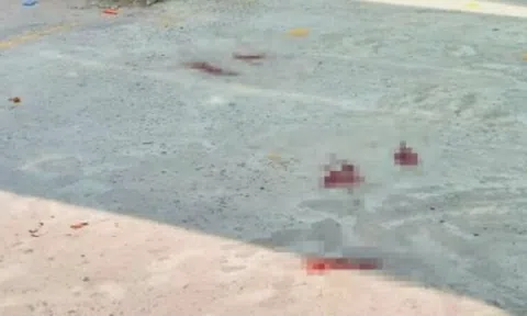 Hậu Giang: Phó hiệu trưởng bị chồng đồng nghiệp chém trọng thương giữa phòng làm việc