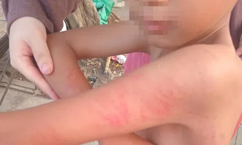 Nữ giáo viên đánh học sinh lớp 1 ở Long An bị kỷ luật, chuyển công tác