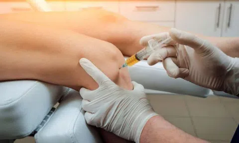 Cảnh báo tai biến sau tiêm khớp, hút dịch khớp không an toàn