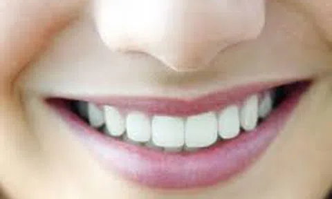 Bị mất răng cấm có trồng được không?