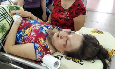 Bốn phụ nữ ở miền Tây bị sét đánh, chảy sợi dây chuyền vàng trên cổ