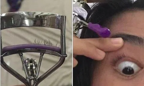 Làm đẹp `lỗi` cô gái nhỡ tay bấm mất hàng lông mi 