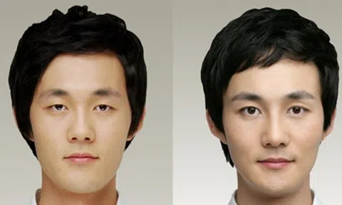 3 điều nam giới cần biết trước khi nâng mũi