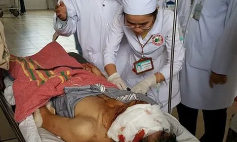 Vụ tai nạn 9 người bị thương, 1 người chết: Tài xế vượt ẩu, sương mù khuất tầm nhìn