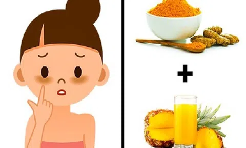 8 loại mặt nạ cực dễ tìm giúp chị em sở hữu làn da láng mịn 