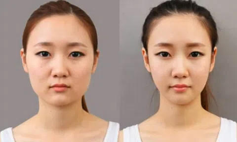 Phẫu thuật thẩm mỹ không phải là cây đũa thần