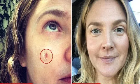  Nữ diễn viên Drew Barrymore chia sẻ công dụng thần kỳ của lô hội tươi