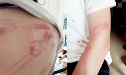 Bố bạo hành hai con đẻ: đó là lần đầu tiên tôi đánh con!