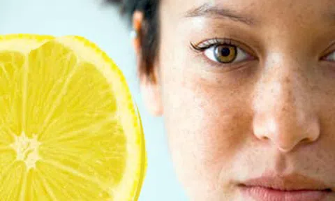 \'Đong đếm\' lợi – hại khi tự đối phó với tàn nhang