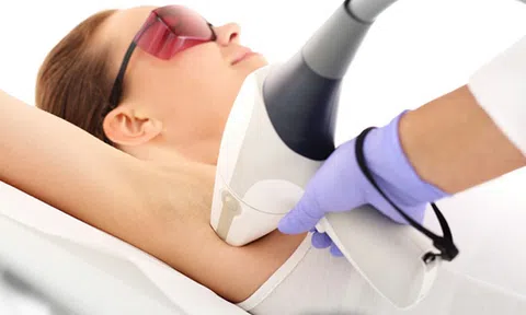 Nên triệt lông bằng tia laser vào thời điểm nào trong năm?